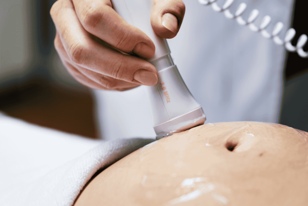 Microdermoabrasión corporal: renovación profunda para una piel radiante